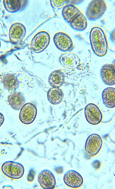 Unknown green alga